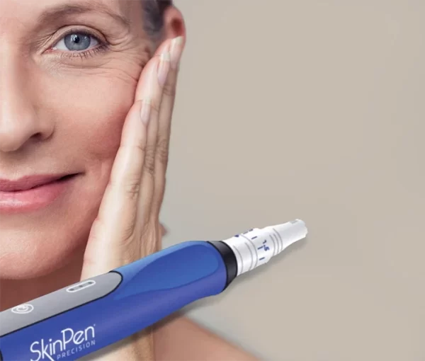 skinpen microneedling